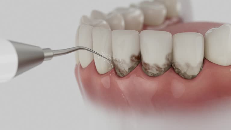 Reliable Dental contractor in Lakes of the Four Seasons, IN by Dentist Open Now